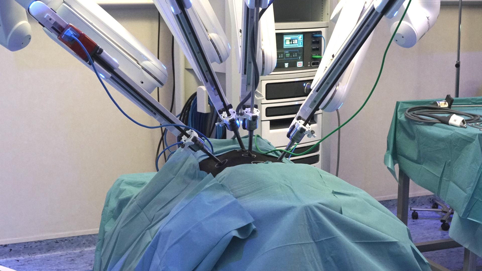 Робот провел операцию. Роботы для микрохирургических операций. Роботизированная хирургия в гинекологии. Дистанционная операция. Дистанционная хирургическая операция.