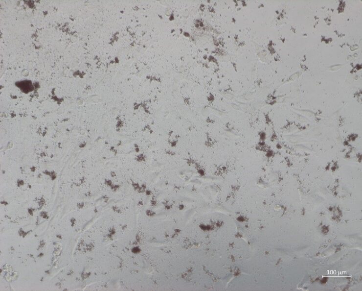 obrazczy-mikrofotografij-fibroblastov-s-nanesennymi-mikrokapsulami-terapevticheskogo-agenta-740x594.jpg