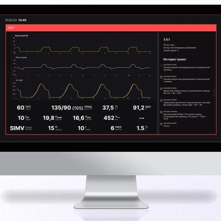 Для отделений интенсивной терапии. Центральная мониторная станция Ростеха успешно испытана в клиниках