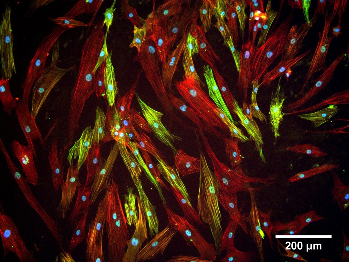 Смоделированное микроокружение. Ученые воспроизвели фиброз в клеточных культурах