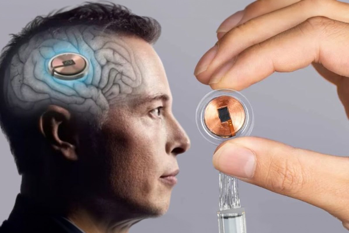 Слепота будет побеждена? Маск готовится вживить чип, возвращающий зрение