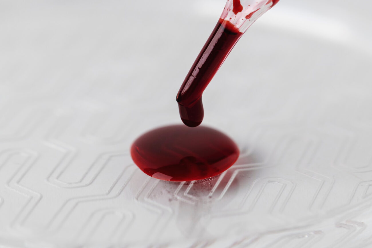 Ученые зафиксировали новую 48-ю группу крови. Уникальный случай обнаружен у женщины из Гваделупы