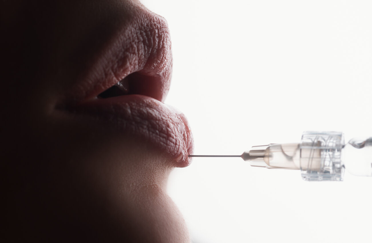 Губы, от которых можно ослепнуть. Врач рассказала, когда инъекции становятся смертельно опасными