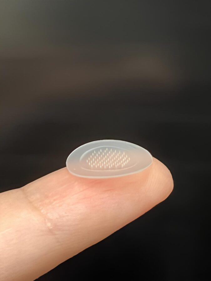 Прыщи исчезают за неделю. Ученые создали уникальные пластыри против акне