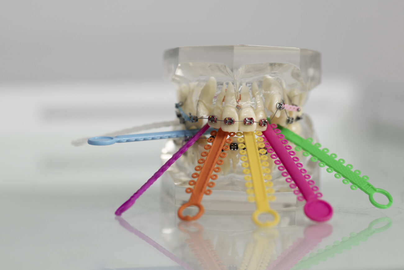 Перемещать зубы без лишних повреждений. Запатентовано устройство для ускоренной коррекции зубного ряда