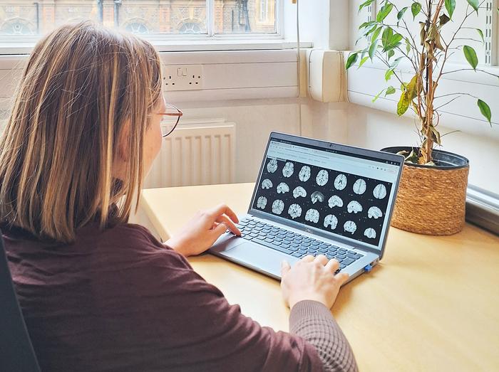 Секреты ярких воспоминаний. Первый в своем роде проект для изучения свойств памяти запустили британские ученые