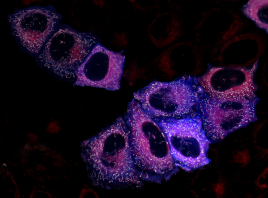 Возможно выбрать цвет флуоресценции. Ученые создали новый тип клеточного биосенсора пероксида водорода