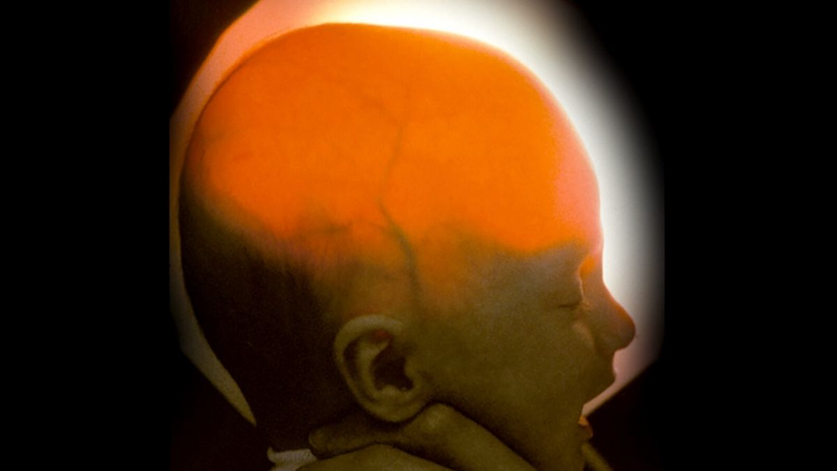 Ребёнку давали меньше года. Но её 20-й день рождения стал пощёчиной всем прогнозам