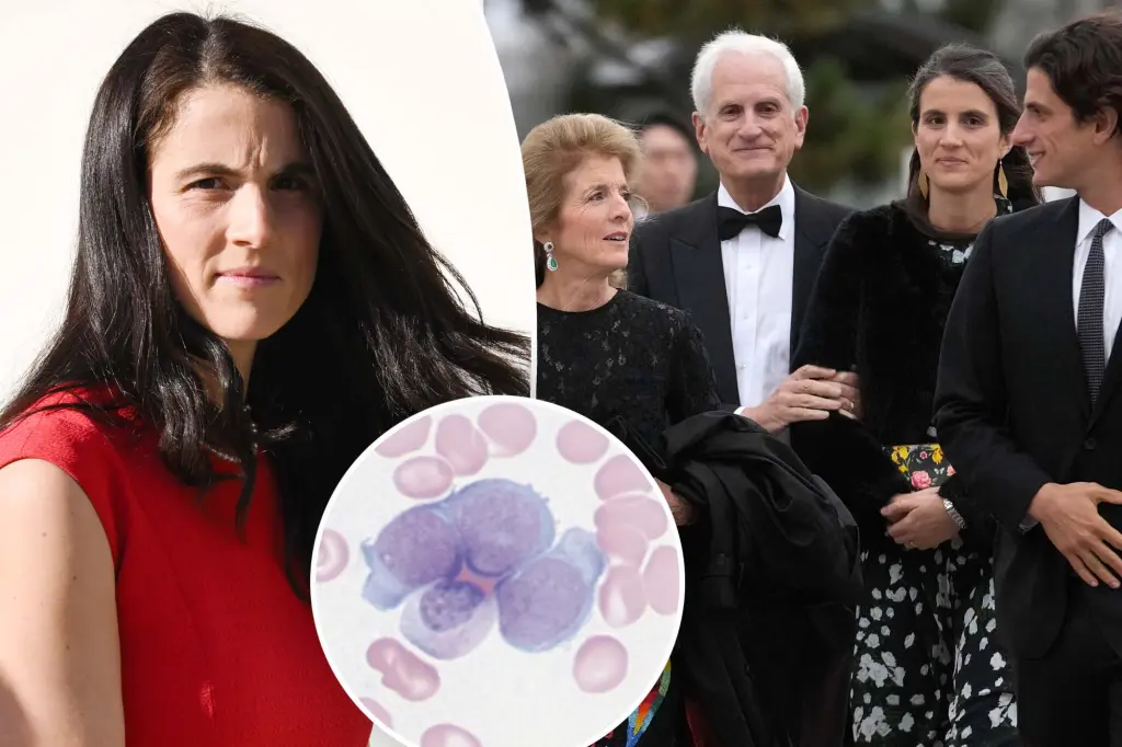 Редкая поломка в ДНК внучки Кеннеди. Специалисты описали генетическую мутацию, укоротившую ей жизнь