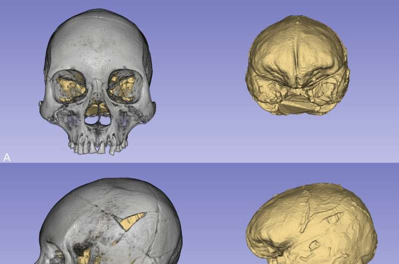 Новое исследование: как питание, окружающая среда и генетика влияли на антропометрические данные людей