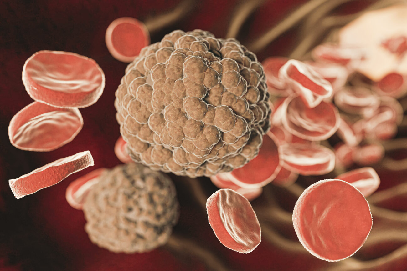 Риск ранней смерти. Исследователи назвали неожиданный фактор, связанный с внезапным летальным исходом