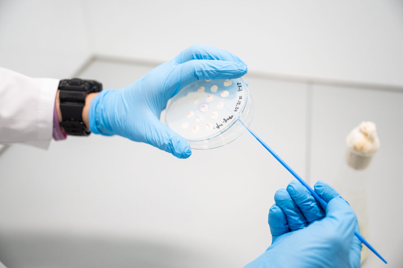 На основе фермента декстраназы. Инновационный гель для борьбы с кариесом разработали ученые РФ