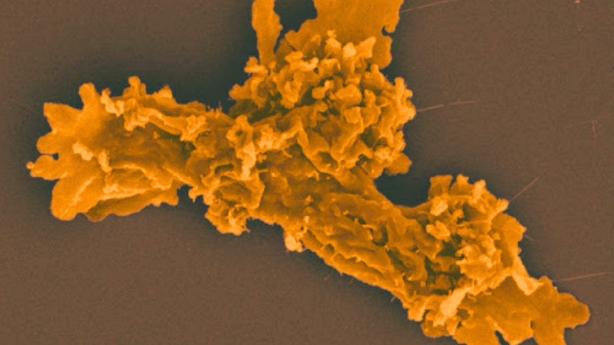В Калифорнии нашли «огненную» амёбу: она делится при 63 °C