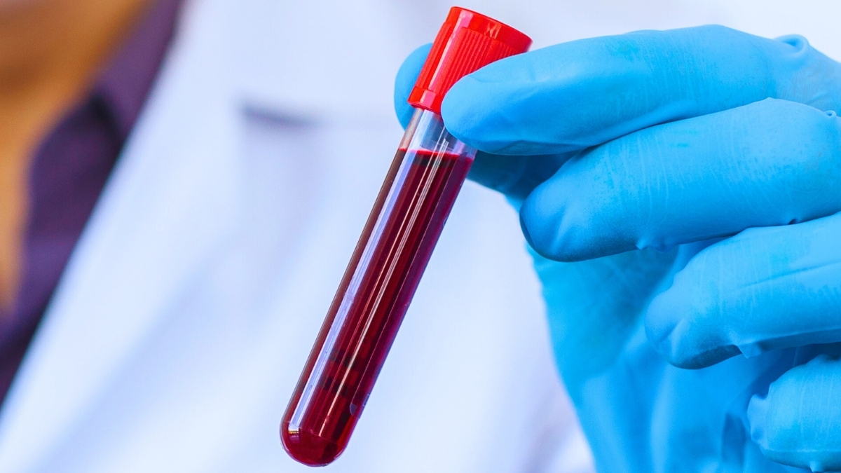 Анализ крови показал риск смерти на 5–10 лет вперёд: что нашли учёные