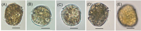 Впервые в российских водах. Токсичные водные растения могут нанести вред здоровью людей и экономический ущерб