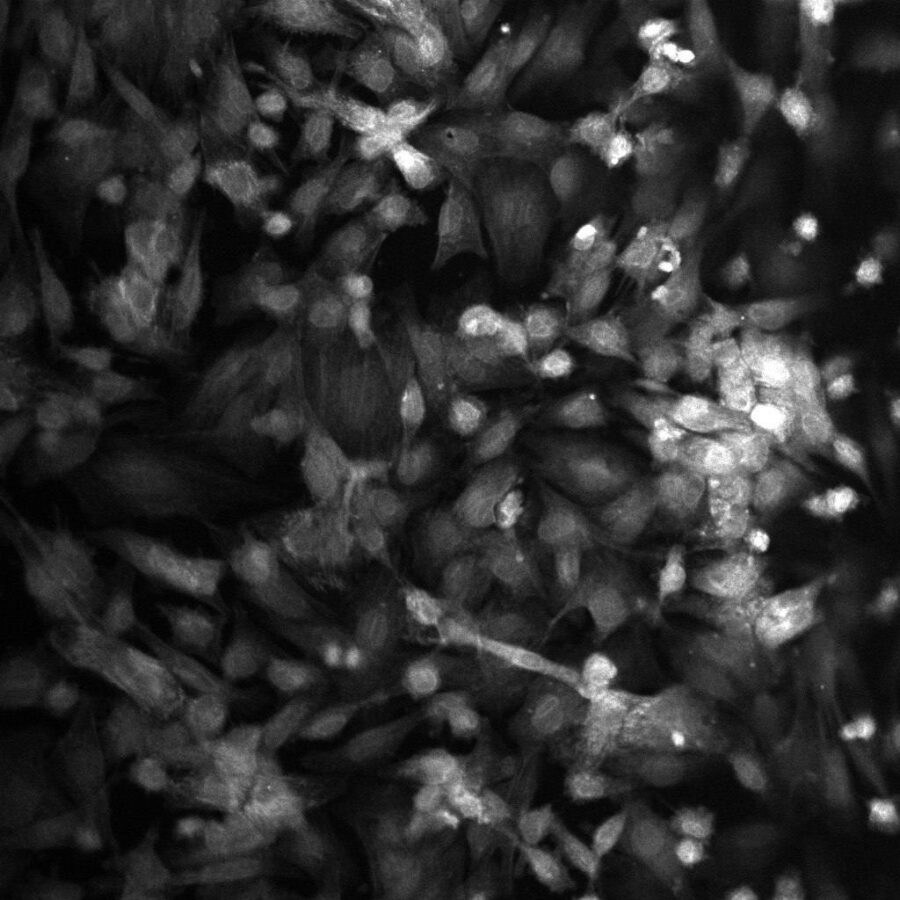 Без использования органа. Ученые смоделировали аритмию на культуре клеток сердца