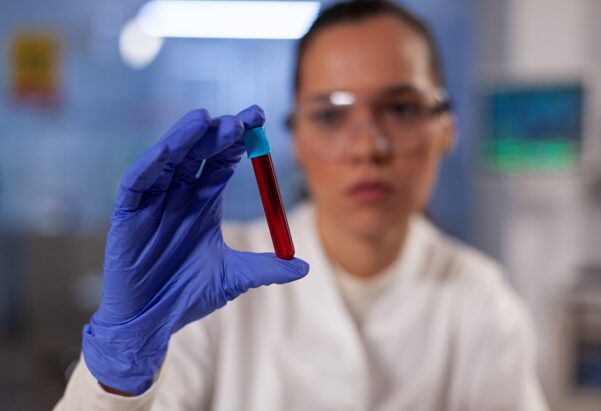 Набор биомаркеров. Ученые рассказали, как выявить риск целого «букета» заболеваний в будущем