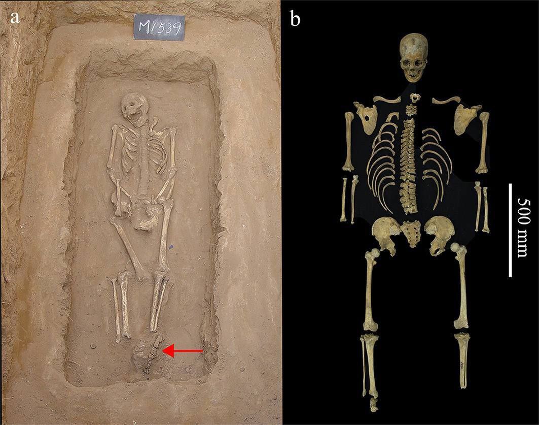 Тайна отрубленной ноги: кара за преступление или ампутация? Антропологи изучили 2200-летнее погребение