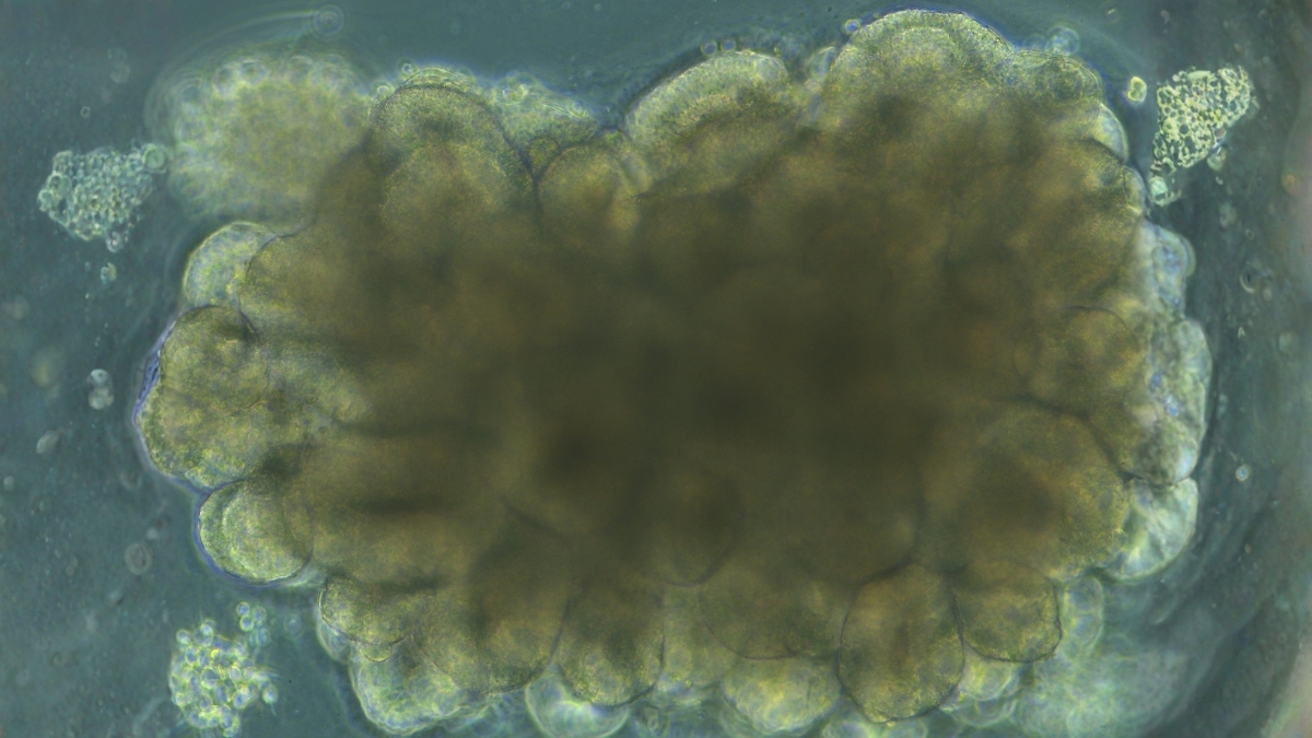 Учёные вырастили мини-мозги, а затем научили их решать инженерную задачу