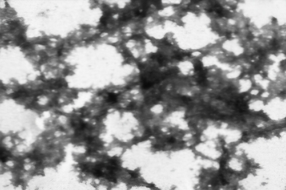 Новое исследование: обнаружен механизм влияния прионного белка на развитие болезни Паркинсона