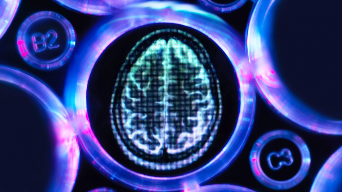 В 55–65 лет это можно не заметить: редкая форма деменции начинается со зрения