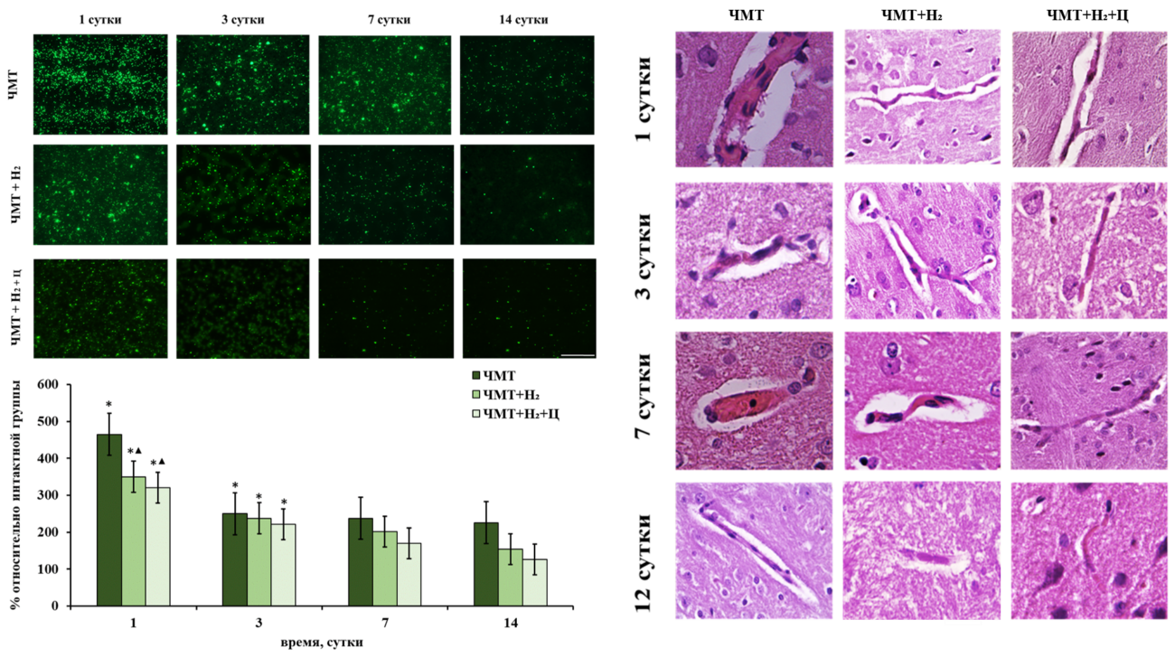 С помощью молекулярного водорода. Ученые разработали способ восстановления функций мозга после ЧМТ