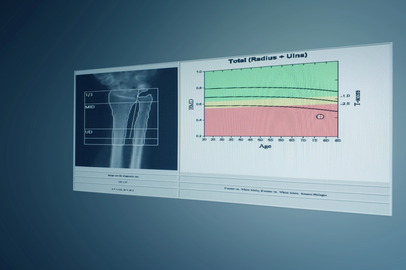 ИИ против очередей на МРТ: нейросеть-«рентгенолог» ставит рекорды скорости