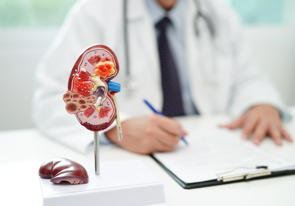 Неочевидная связь печени и почек: как застой желчи запускает смертельный механизм в организме