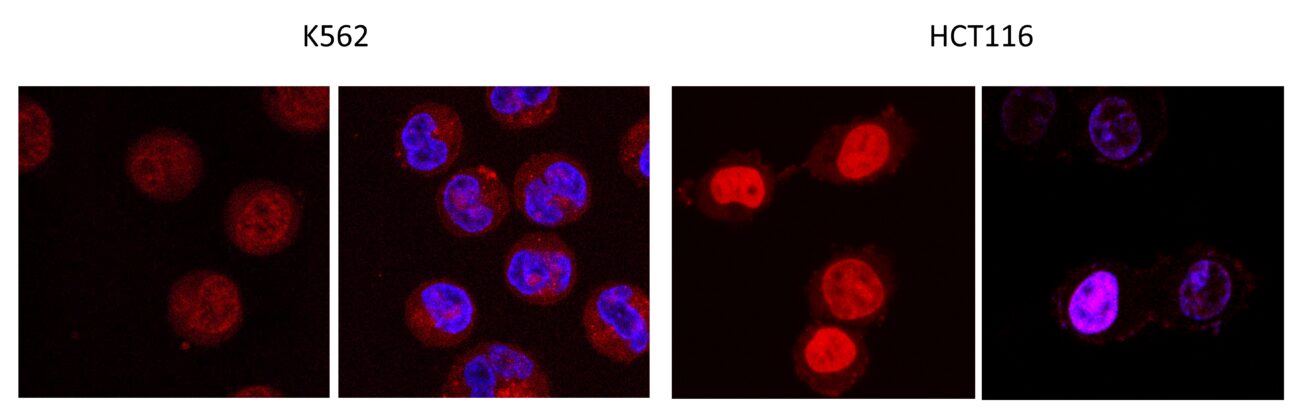 Прорыв в онкологии: ученые “перезарядили” известное лекарство, чтобы победить устойчивые формы рака