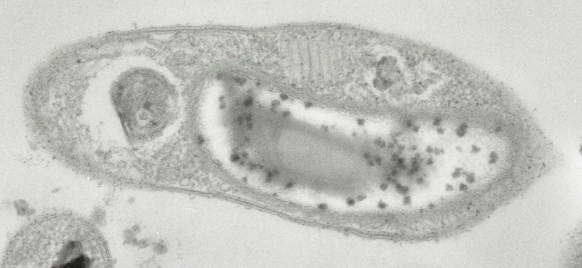 «Смелый путешественник» из преисподней: сибирские микробы, которые «застыли во времени»