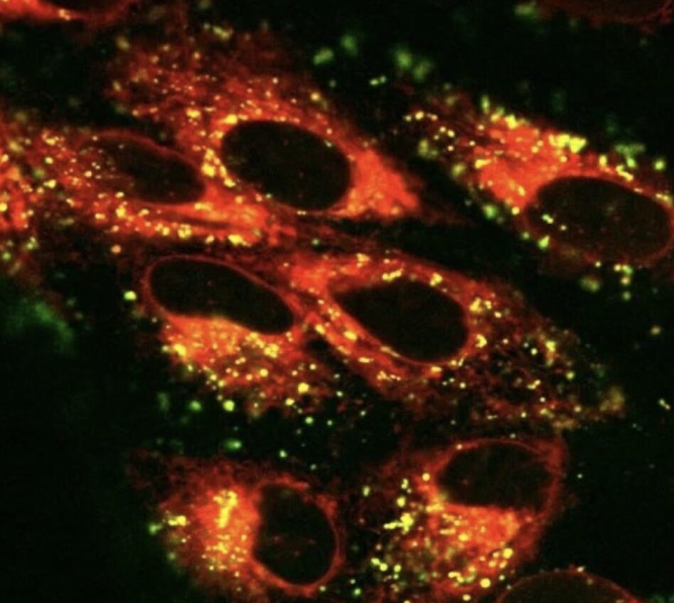 Светящийся мусор в глазу: ученые нашли способ измерить “пигмент старения” и спасти зрение