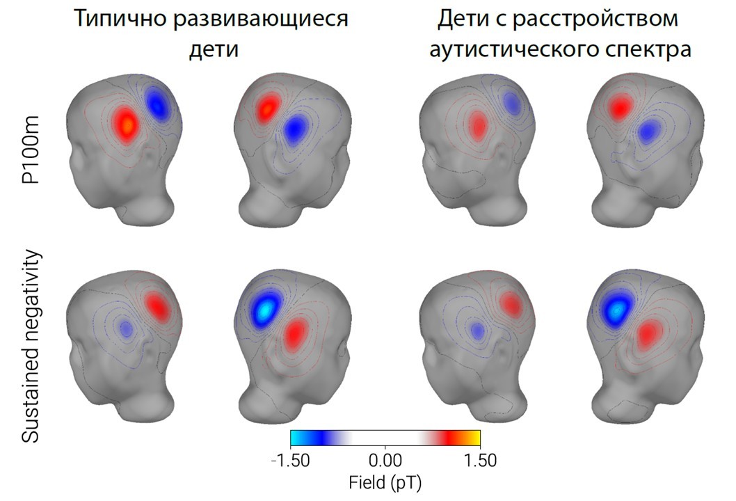 Звуки, которые не слышат: как мозг детей с аутизмом обрабатывает шум и речь иначе, чем у остальных